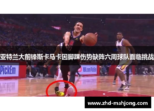 亚特兰大前锋斯卡马卡因脚踝伤势缺阵六周球队面临挑战